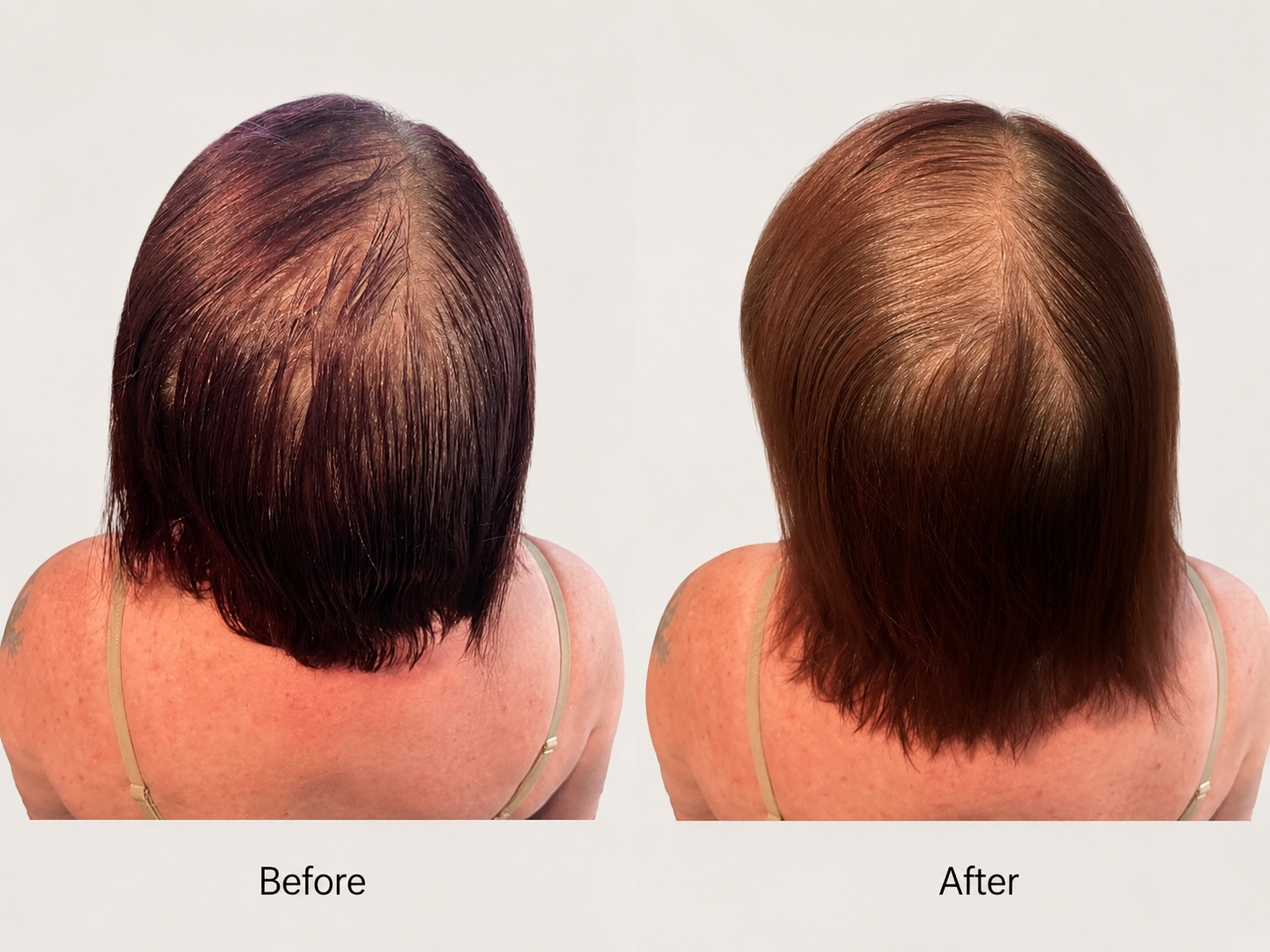 Scalp & Hair Growth Support Oil Serum