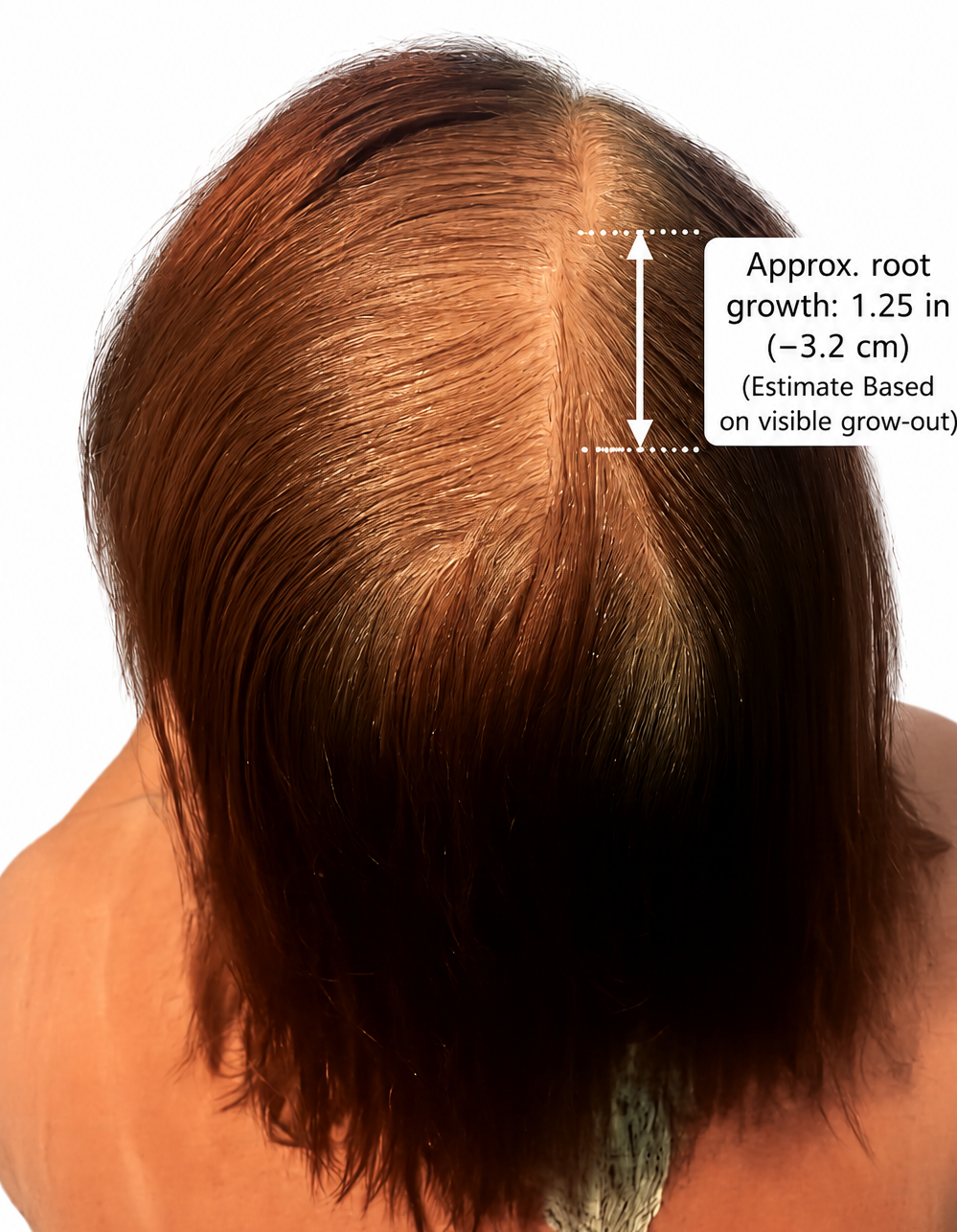 Scalp & Hair Growth Support Oil Serum